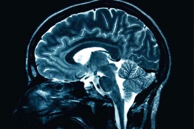 Air pollution may damage brain