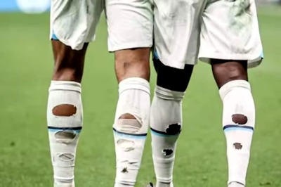 Why Footballers Have Holes In Their Socks