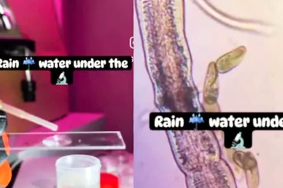 Watch: How Rainwater Looks Under Microscope