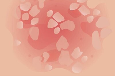 How Are New Psoriasis Treatments Impacting Patients' Lives?