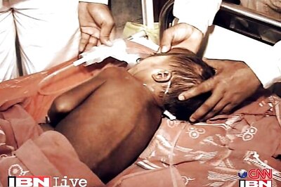 UP: Encephalitis claims two more lives, toll 159