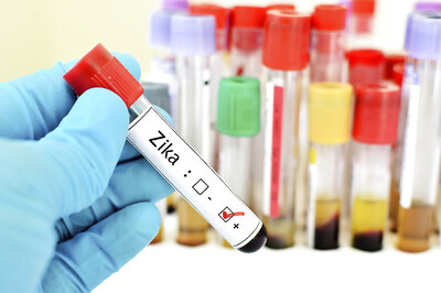 Kissing Unlikely to Pass on Zika Virus: Researchers