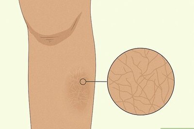 13 Common Causes Behind Itchy Legs (and How to Treat Itchiness)