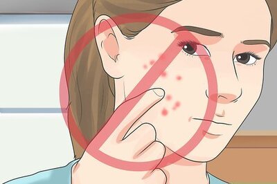 How to Resist the Temptation of Popping Pimples