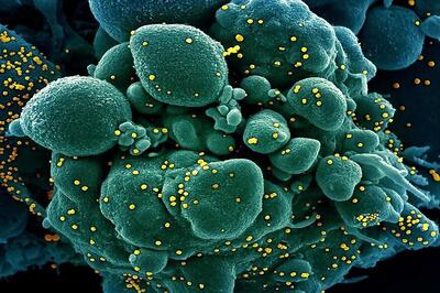 What Are the Symptoms? Is There a Cure? Your Coronavirus Questions Answered