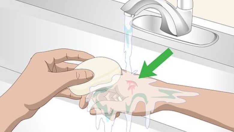 How to Treat and Prevent Macaw Bites