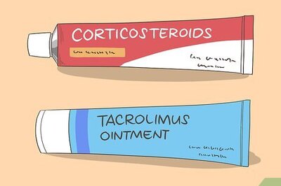 How to Treat Vitiligo