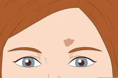 What Does Your Birthmark Mean Spiritually?