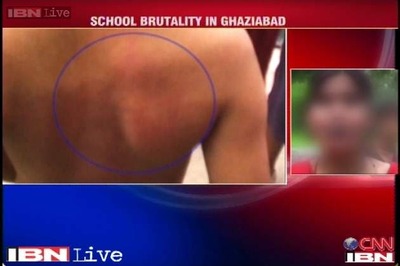 Kindergarten horror: Six-year-old mercilessly beaten by school teacher in Ghaziabad