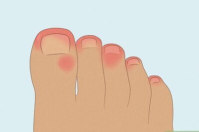 What Is Trench Foot? Home Remedies, Causes, & More