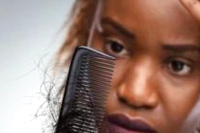 Tips And Tricks To Manage Excessive Hair Fall