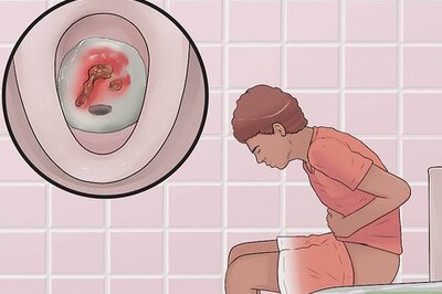 How to Distinguish Ulcerative Colitis from Similar Conditions