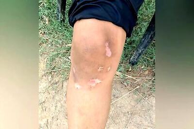 Class 10 Student Tortured, Assaulted by School Owner, Coaches in Haryana; Hospitalised