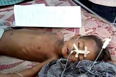 No end to Encephalitis deaths in Gorakhpur; toll now reaches 358