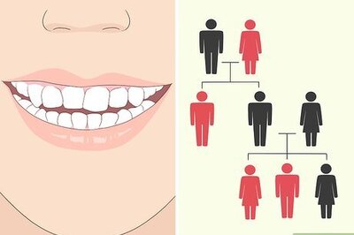 How to Fix an Uneven Smile and Look Your Best