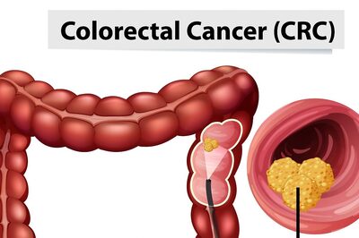 Colorectal Cancer: Mental Health Issues and Management