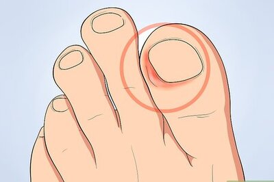 How to Tell if an Ingrown Toenail Is Infected