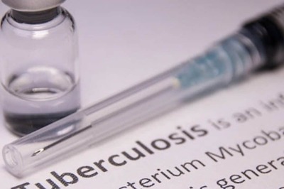 West Bengal: Kolkata Reported 13,316 TB Cases in 2022, Azuthorities Concerned