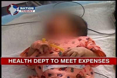 J&K govt offers to help baby girl with cleft lip