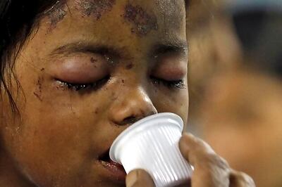 Thane: 4-yr-old recovered from debris opens her eyes