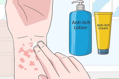 How to Treat Lichen Planus at Home