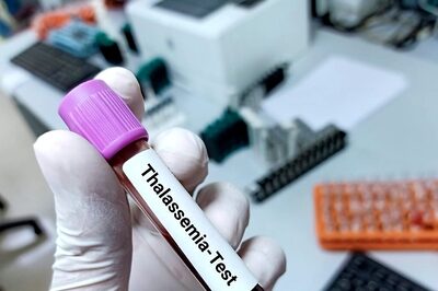 Govt Must Integrate Thalassemia with Sickle Cell Elimination Target of 2047, Chief of NTWS Says