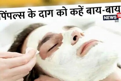 Home Remedies For Pimples And Scars For Men