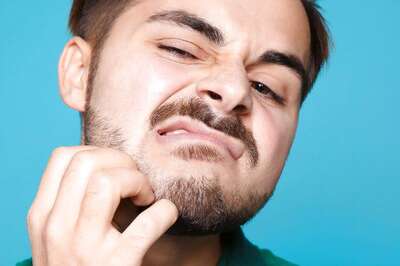 Here are Tips by Dermatologist on How You Can Combat Beard Dandruff