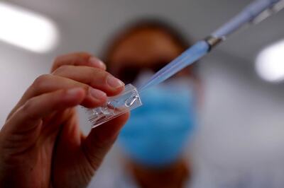 Covid Pandemic Caused Prolonged Decline in Global Life Expectancy: Study