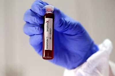 Two European Patients Re-infected With Coronavirus - Reports