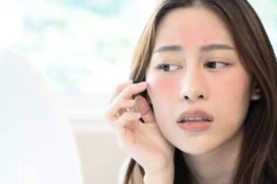 World Liver Day 2023: Signs Of Fatty Liver Disease On Your Face That You Must Not Ignore