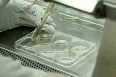 Stem cells to repair spinal cord injuries?