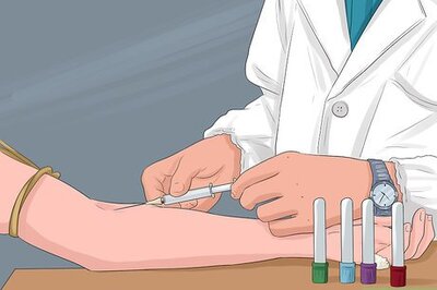 How to Prevent Jaundice in Newborns