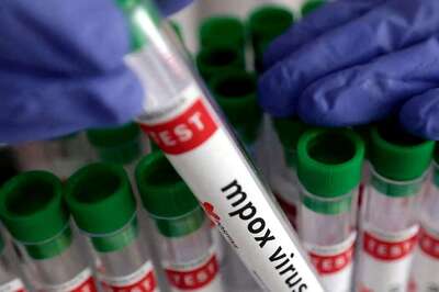 Suspected Case Of Mpox Reported At Jaipur Airport, Patient Admitted To RUHSH