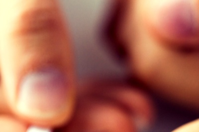 For Men and Women, Origins of Diabetes May Be Different: Study