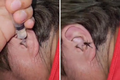 Is It Real? This Video Of Spider Crawling Out Of Man's Ear Is Super Creepy