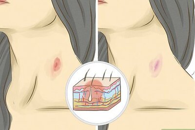 How to Give Someone a Hickey